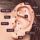 아주 쬐금 늦은 일요일 오후 피어싱 후기