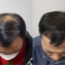 한올SMP 네이버블로그