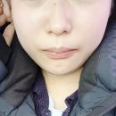 유진치과의원 | [광주]사랑니 발치는 더블엠 구강악안면 치과의원/매복사랑니전문/한번에 3개 뽑은후기