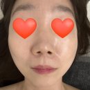 서면mts관리 서면피부관리실 나경뷰티 솔직후기