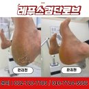 레푸스검단로브