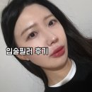 위례 입술필러후기!자연스럽게 인중축소도!