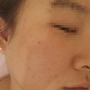 영인메디칼 | 구리피부관리 올가드림뷰티에서 관리받은 후기