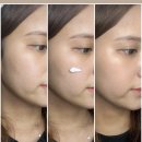 태양메디 이미지