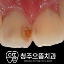 청주으뜸치과 이미지