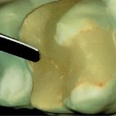 본치과기공소 이미지