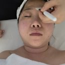 서면윤곽관리 코아페이즈 솔직 후기 코아웨딩+하이푸 리프팅으로 얼굴 소멸 직전