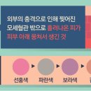 멍라이프 SBS