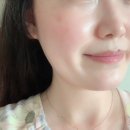 바른선 테라피