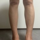 평화의원 | 상상하던 몸매 만들기 대구 지방분해주사의원 1주차후기