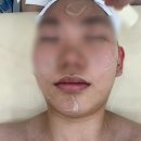 지에스25 청주석판점 | 청주 신부관리 추천 피아나뷰티랩 시그니처 윤곽관리 후기｜예신관리부터 얼굴라인 관리까지 만족
