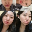 서래로10길 26 (2) | [익산] 익산피부관리 모현동피부관리 에르떼, 익산마사지 익산에스테틱 익산피부샵 후기✨