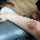 방학을 이겨내는법 + 웅님휴가시작 + 깁스풀다 + 치과 + 개학