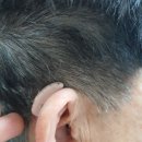 시그니아보청기 분당센터 | 친절한 상담 시그니아보청기 창동 전문센터 방문 후기