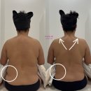 에스테틱 다리아 등신경테라피 받고 온 솔직 후기