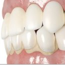 석탑치과의원 이미지