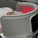 예쁜여우뷰티 | 남편 탈모관리 시작! 수진역 쎈모 생장술 후기