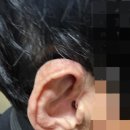 포낙보청기송파잠실센터 | 종합운동장역 보청기 | 아버지 보청기 맞추고온 포낙보청기 송파잠실센터