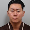 릴리성형외과의원 | 남자 눈밑지 수술 ‘대구 릴리성형외과’ 후기! (내돈내산)