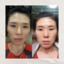 [홈에스테틱 피부관리] 이수연코스메틱의 홈에스테틱 리얼후기!