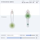 새이처럼치과의원 | 구미 치과 에서도 찾아주시는 대구 보철물 파절 치료 치과