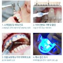 미백세탁 이미지