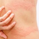 이호석한의원 이미지