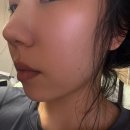 비너스 | 강남 하이코 코실리프팅 받고온 찐 후기, 비너스코로 코라인 정리한 이야기