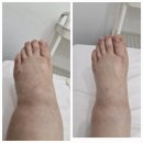 마사독산 | 통증·염증에 특화된 '사독관리' 첫 경험기 (톡시온 사독앰플 리뷰)/오산바디관리 /오산대역바디관