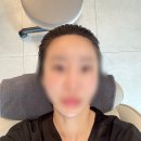 일산 두피관리 전문 모바이오 일산점 후기