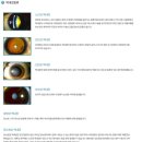 송탄안과의원 이미지