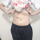 수의원 | 상상하던 몸매 만들수 있는 복부 지방분해주사 강남 의원 1차 후기