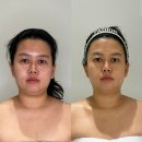 F5에스테틱 | 울산 윤곽관리 입소문 자자해서 매달 초 예약 마감되는 에프오에스테틱