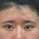 슈어스성형외과의원 이미지