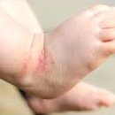 벨르스킨 이미지