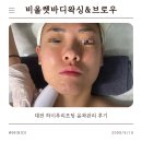 비올렛 | 대전 하이푸리프팅 윤곽관리 후기｜이중턱 고민 끝! 비올렛바디왁싱&브로우 리얼체험