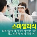 안경오케이콘택트 | 스마일라식 회복기간부터 각막두께 안전 기준, 참고 비용 및 실제 경과 후기 총정리