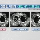 면역력으로 암을 치료한다?! 최신 암 치료법 '면역항암제' 이미지