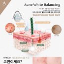 더블유에이씨
