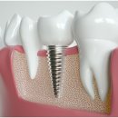 가우정인 이미지