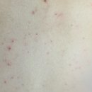 라비안느 | 강남등드름 내돈내산 후기 #라비안느토탈뷰티