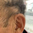 홍천보청기 어르신의 고민을 해결해주는 센터