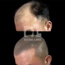다크라인 - 강릉시 용지로 148 | 다크라인