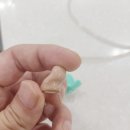 인천보청기 이미지