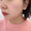 수원 영통 피부관리 슬기로운에스테틱 영통역 에스테틱 모공관리 후기