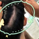 퇴계원역 | 두피 고민 타파! 숲칼프 남양주퇴계원역점에서 찾은 풍성함의 비밀