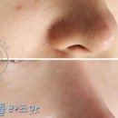 뷰티초이스 이미지