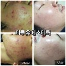 미투유 에스테틱 | 영도피부관리 미투유에스테틱 트로이필 소개