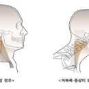 365차차짐이천하이닉스 이미지