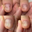 한남역 | 한남역 네일샵 손톱 큐티클 제거 관리 후기